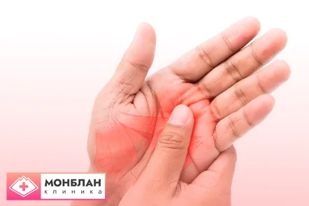 Услуга лечения алкогольной полинейропатии